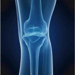 knee-joint-3