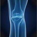 knee-joint-3